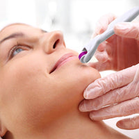Thumbnail for Derma Roller 4 In 1 Derma Roller