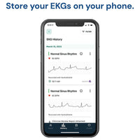 Thumbnail for AliveCor KardiaMobile Smart ECG/EKG and Heart Monitor