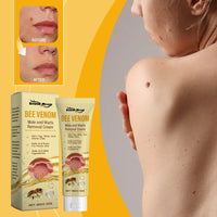 Thumbnail for Bee Venom Skin Tag Remover