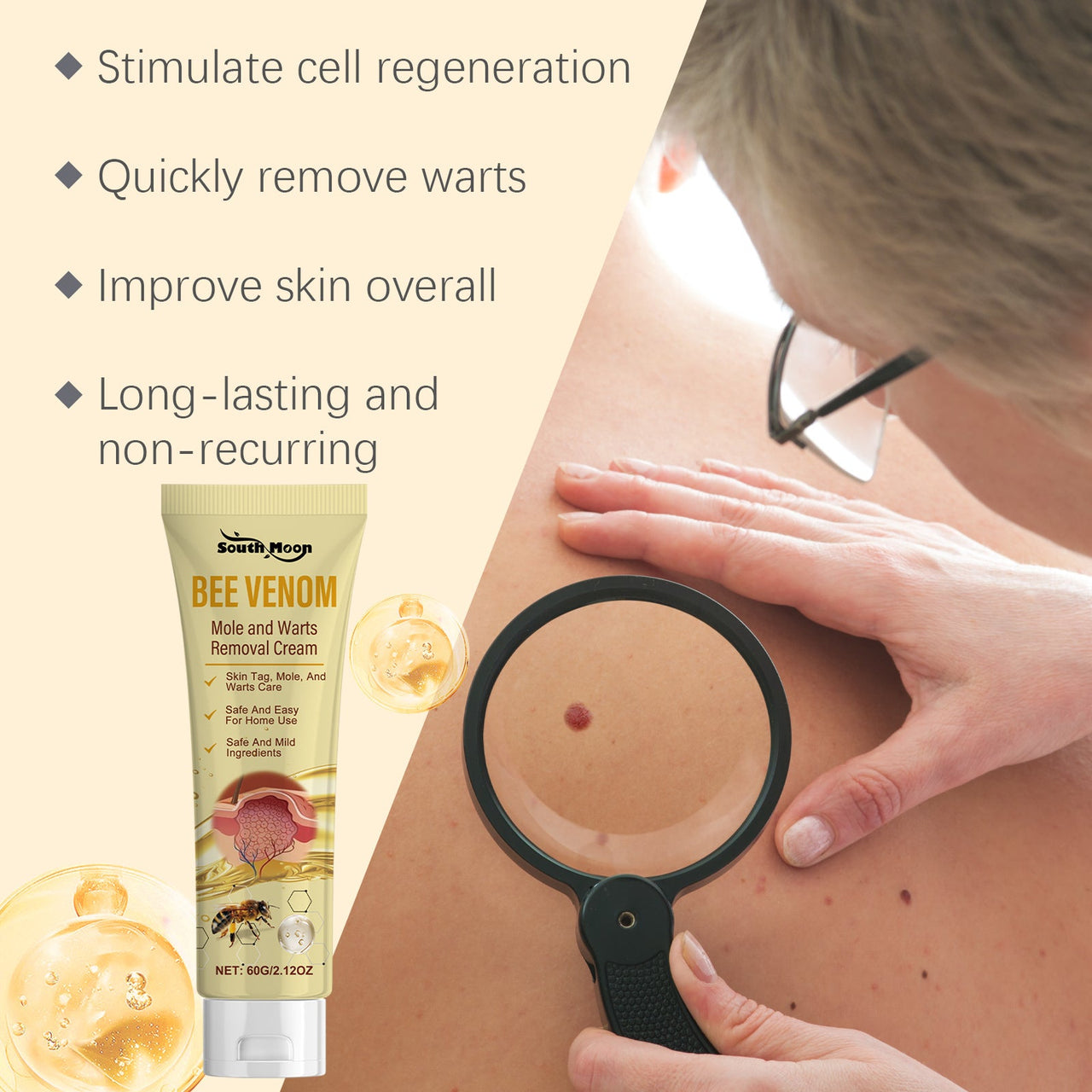 Bee Venom Skin Tag Remover