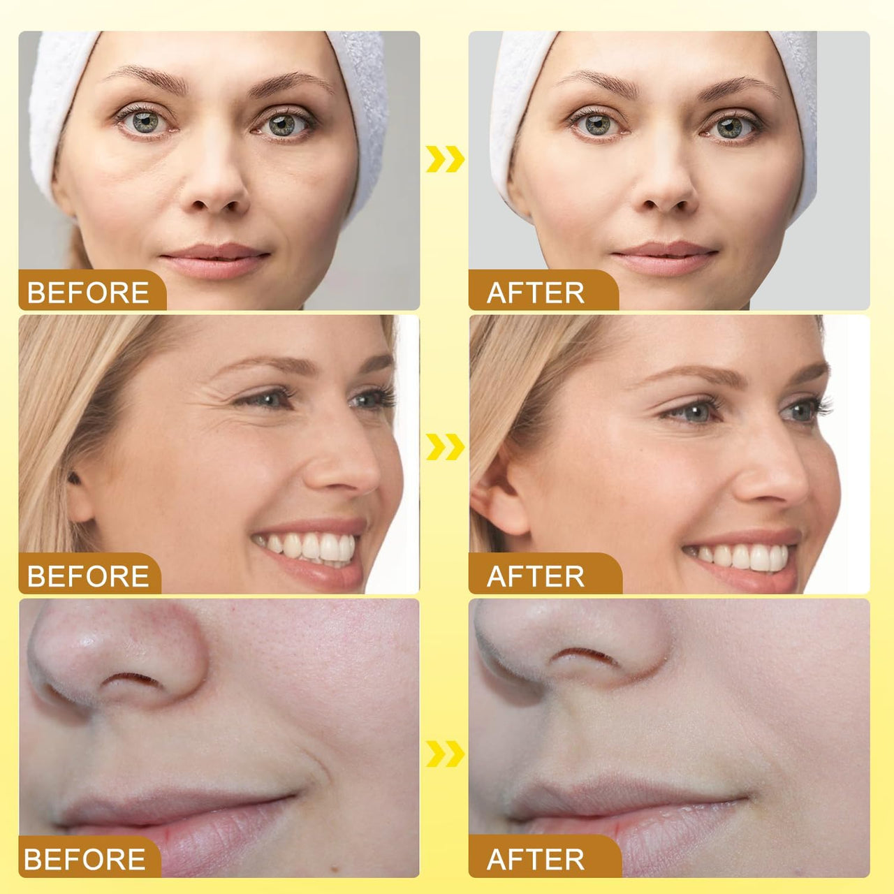 Bee Venom Botox Wrinkle Anti Aging Cream