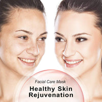 Thumbnail for LED Light Therapy Face Mask