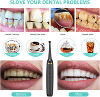 Thumbnail for Electric Dental Calculus Remover Tooth Cleaner
