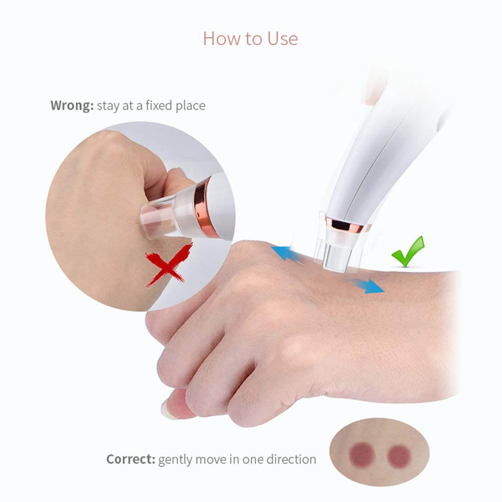 Black Head Remover Acne Cleansing High-pressure Suction - The Shopsite