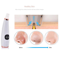 Thumbnail for Black Head Remover Acne Cleansing High-pressure Suction - The Shopsite