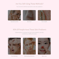 Thumbnail for Black Head Remover Acne Cleansing High-pressure Suction - The Shopsite