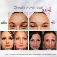 Thumbnail for LED Light Therapy Face Mask