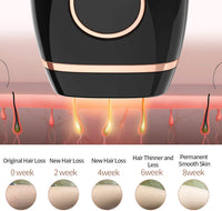 Thumbnail for IPL Hair Removal Device – Permanent Hair Removal for Women & Men