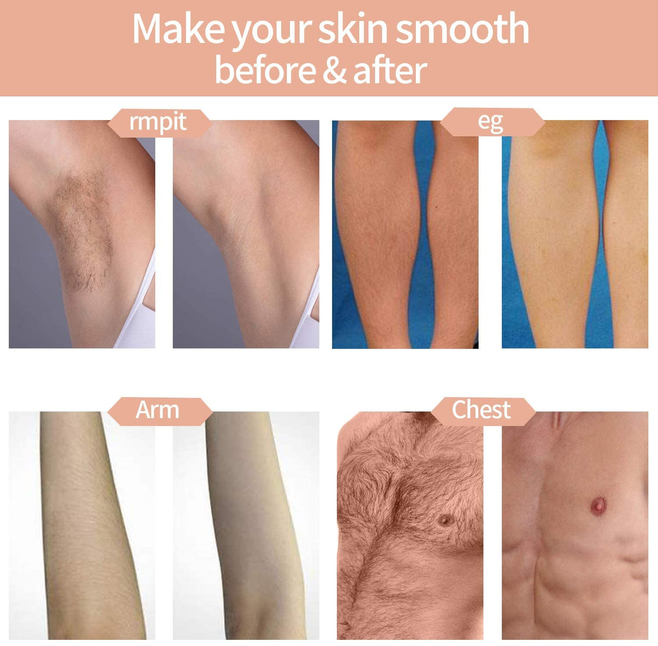 IPL Hair Removal Device – Permanent Hair Removal for Women & Men