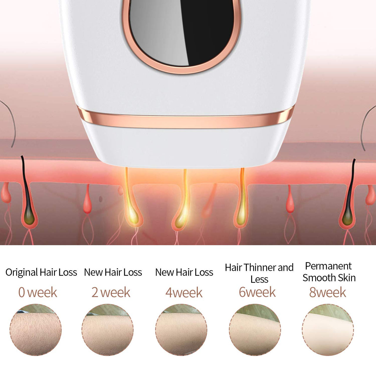 IPL Hair Removal System, Permanent Painless 999,999 Flashes