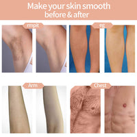 Thumbnail for IPL Hair Removal System compact and portable