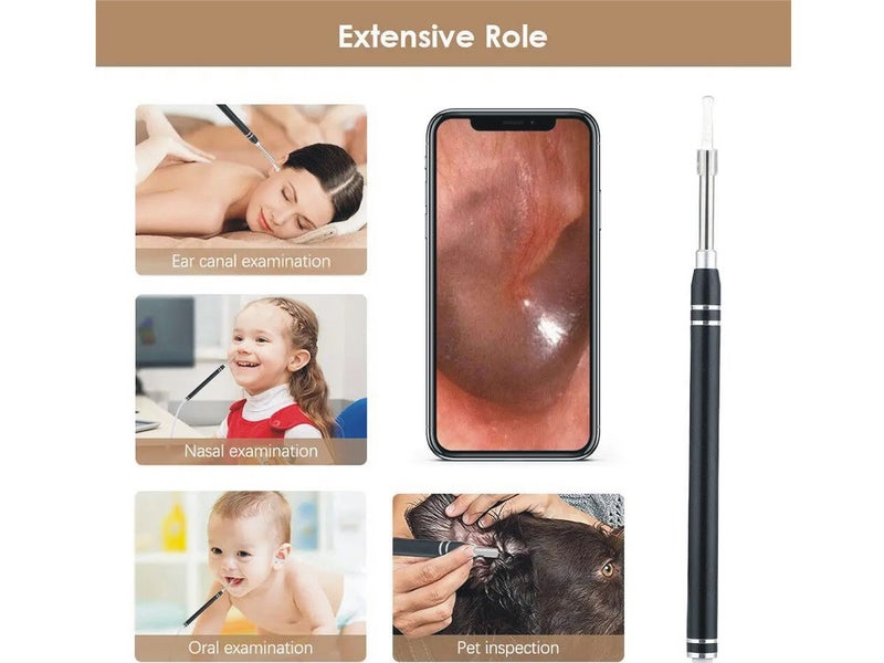 Smart Ear Camera Ear Cleaner Otoscope