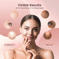 Thumbnail for Red Light Therapy Mask