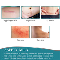 Thumbnail for Silicone Scar Sheets