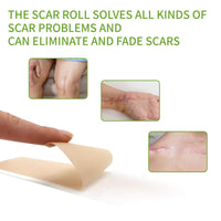 Thumbnail for Silicone Scar Sheets