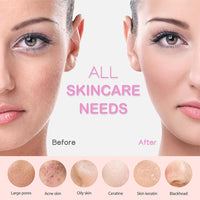 Thumbnail for Electric Facial Cleansing Brush