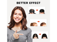 Thumbnail for Laser Hair Growth Cap