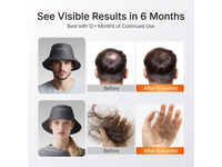 Thumbnail for Red Light Therapy Hair Grow Cap
